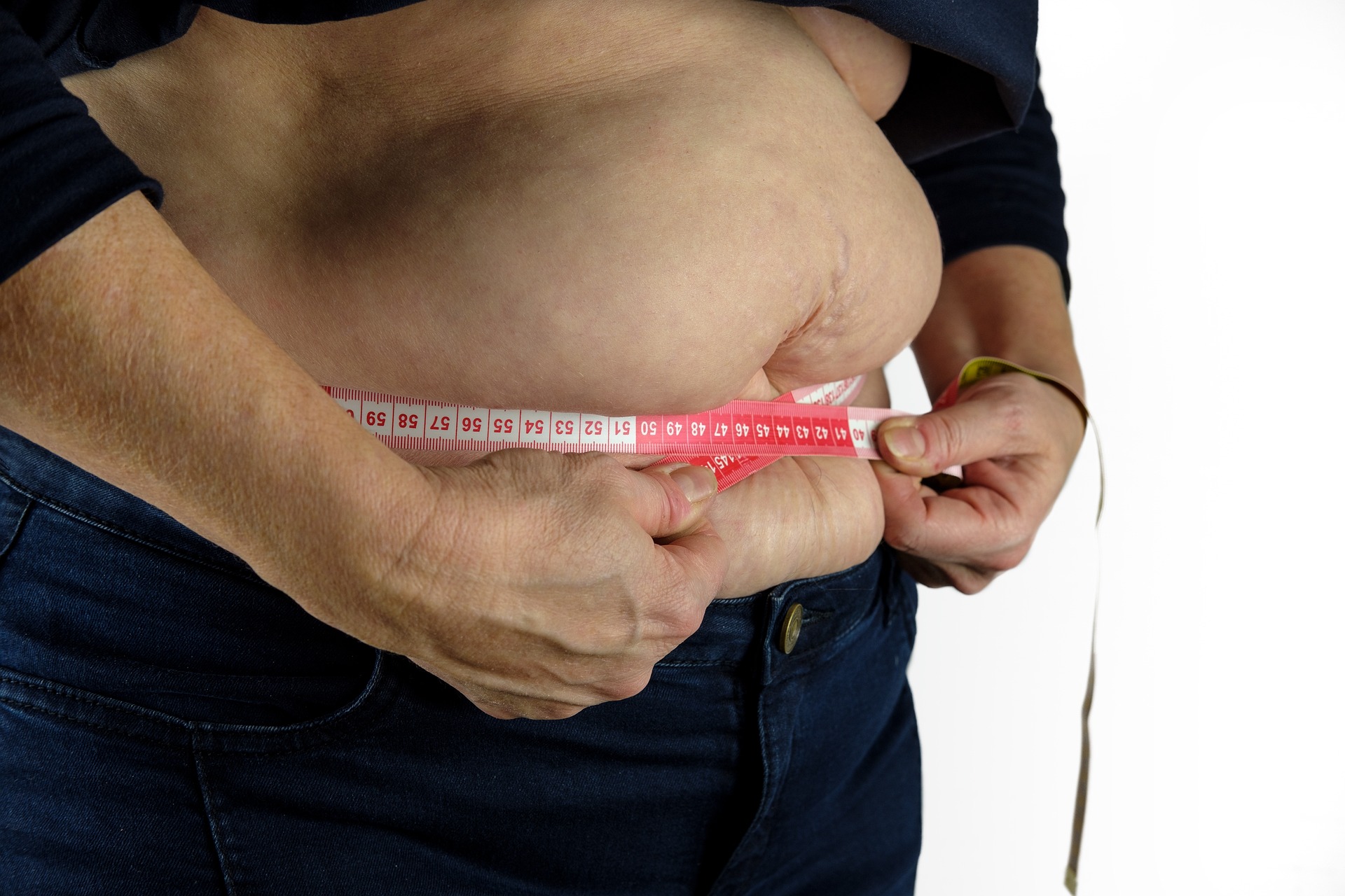 Obesity how to manage obesity?